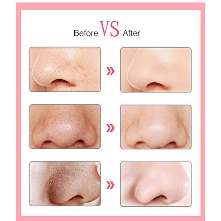 Büro Ev Ofis Kişisel Bakımı için 6 Başlıklı Siyah Nokta Temizleyici Vakum Aparatı