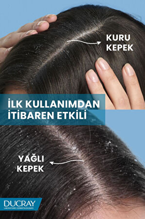 Ducray Kelual Squanorm Kepek Karşıtı Losyon 200 ml