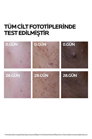 La Roche Posay Effaclar Duo+M Yağlı, Akne/Sivilce Eğilimli Ciltler için Yüz Bakım Kremi 15ml