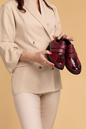 Gondol Hakiki Deri Kadın Kemik Çıkıntısına Özel Ayakkabı vdt.1670