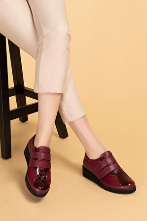 Gondol Hakiki Deri Kadın Kemik Çıkıntısına Özel Ayakkabı vdt.1670