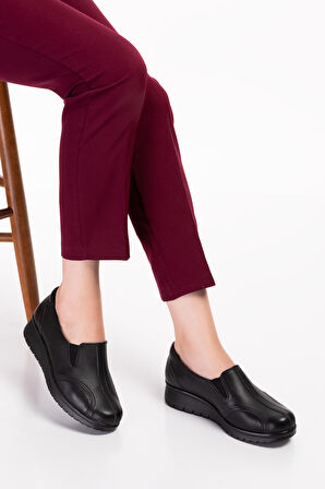 Gondol Hakiki Deri Kadın Kemik Çıkıntısına Özel Ayakkabı elnr.5778