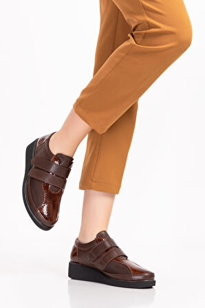 Gondol Hakiki Deri Kadın Kemik Çıkıntısına Özel Ayakkabı vdt.1670