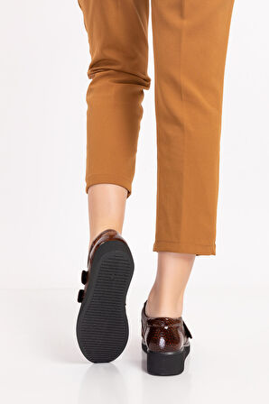 Gondol Hakiki Deri Kadın Kemik Çıkıntısına Özel Ayakkabı vdt.1670