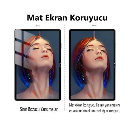 Doogee T10E 10.1 İnç Mat Ekran Koruyucu Nano Şeffaf