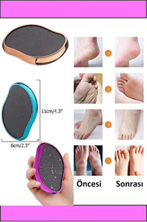 Peeling Ayak Topuk Törpüsü