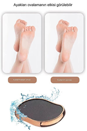 Peeling Ayak Topuk Törpüsü