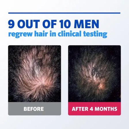 Men 1 Aylık Köpük