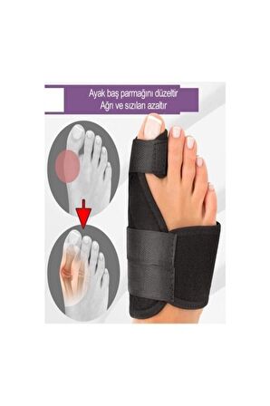 Newconcept Halluks Valgus Gece Ateli Ayak Bunyon Kemik Koruyucu 1 Çift (sağ Ve Sol)