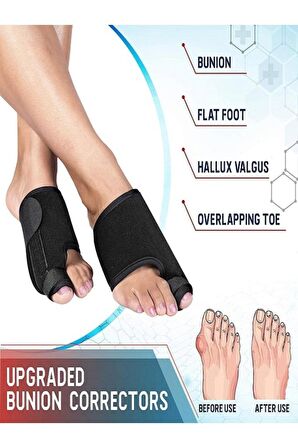 Newconcept Halluks Valgus Gece Ateli Ayak Bunyon Kemik Koruyucu 1 Çift (sağ Ve Sol)