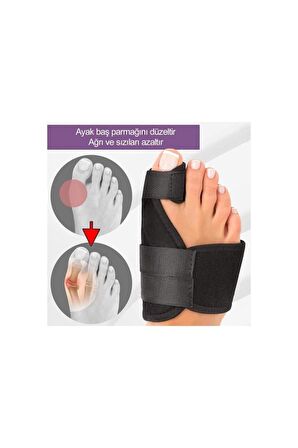 Halluks Valgus Ayak Ateli Ayak Başparmak Kemiği Çıkıntısı Bunyonu Düzeltici