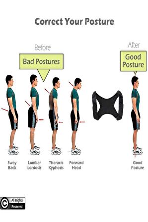 Yeni Nesil Dik Duruş Korsesi Kamburluk Önleyici Terletmez Korse Unisex Siyah