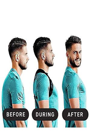 Spor Dik Duruş Korsesi Kamburluk Önleyici Yeni Nesil