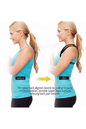 Kemerli Medikal Erkek Kadın Kamburluk Önleyici Dik Duruş Korsesi Posturex Dik Durmayı Sağlayan Bel