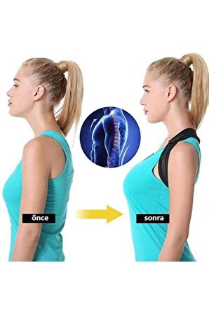 Unisex Siyah Dik Duruş Korsesi Kifoz Skolyoz korsesi