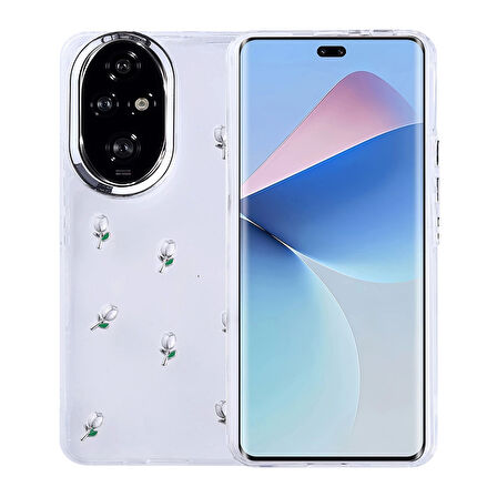 Honor 200 Uyumlu Kılıf Airbag Tasarımlı Simli Şeffaf Kutup Kapak