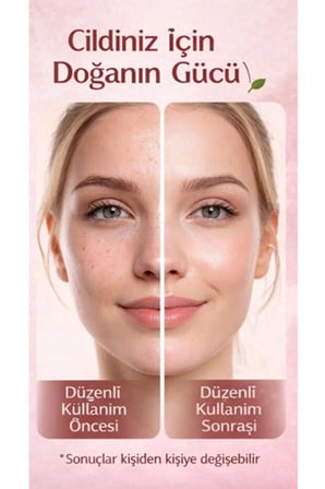 Doğal günlük Boswellia (Frankincense) Özlü Doğal Serum – 50 ml