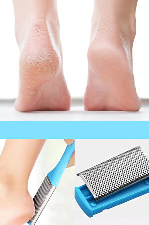 Ayak Topuk Ölü Deri Rende Törpüsü Çift Taraflı Xl69