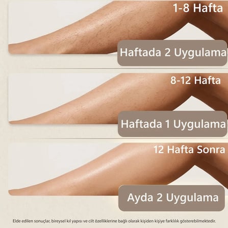 Robx A2030 IPL Sapphire Sogutma 35 joule Ultra Güç Hızlı Etki Çoklu Seri Otomatik Atım Mor
