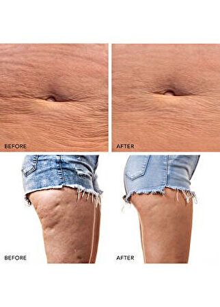 Foreo BEAR 2 Body Lavender Vücut Masaj Aleti