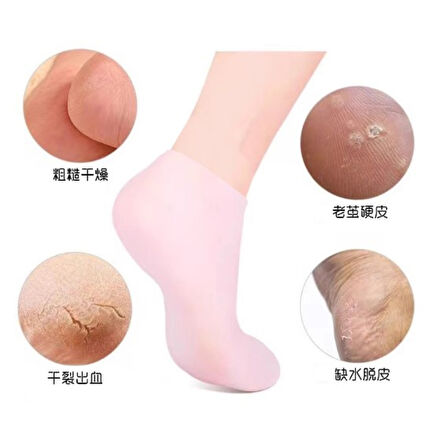 Silikon Nemlendirici Çorap Ayak Bakım Çorabı (4915)