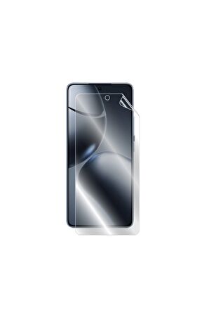 Xiaomi 14T için IPG Hydrogel Ekran Koruyucu