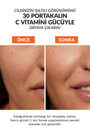 Anew Vitamin C Canlandırıcı Serum 30 Ml.