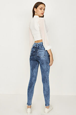 Kadın Yırtık Detaylı Yüksek Bel Skinny Jeans
