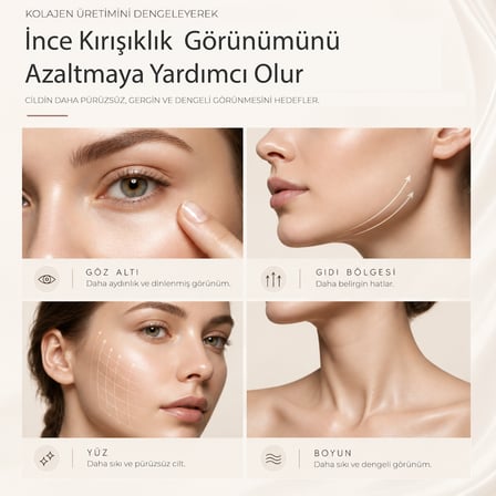 Robx A07 Yeni Nesil RF EMS Cilt Sıkılaştırıcı Ve Kırışıklık Yüz ve Vücut Aleti 