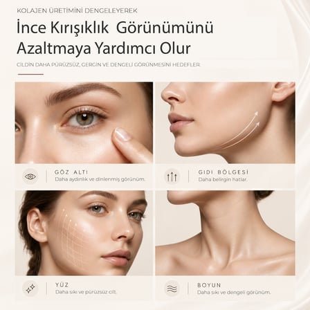 Robx A07 Yeni Nesil RF EMS Cilt Sıkılaştırıcı Ve Kırışıklık Yüz ve Vücut Aleti kırmızı 