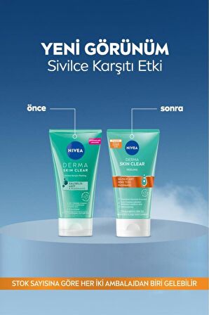 Nivea Derma Skin Clear Sivilce Karşıtı Yüz Temizleyici Peeling 150ml, Salisilik Asit,Niasinamid,Deniz Tuzu