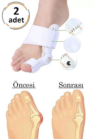 Baş Parmak Kemik Düzeltici Halluks Valgus Ayak Bakımı Ortopedik Bunyon Koruyucu Pratik