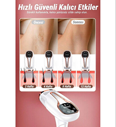 Yeni Nesil IPL Buz Lazer Cihazı Otomatik/Manuel Ayarlanbilir Seviye Tüm vücut Epilasyon 999.999 Atım