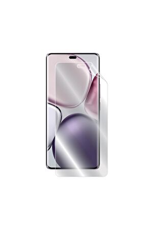 HONOR X9c için IPG Hydrogel Ekran Koruyucu