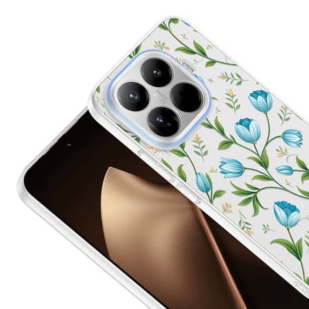 Xiaomi 15T Pro Kılıf Kamera Korumalı Canlı Lüx Desenli Klip Sert Kapak Mavi Lale