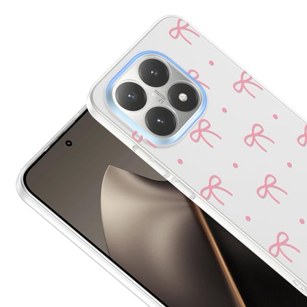 Xiaomi 15T Kılıf Kamera Korumalı Canlı Lüx Desenli Klip Sert Kapak Fiyonk