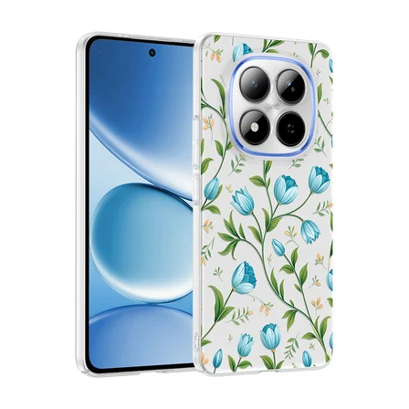 Xiaomi Redmi Note 15 Pro 4G Kılıf Kamera Korumalı Canlı Lüx Desenli Klip Sert Kapak Mavi Lale