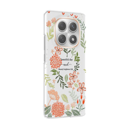 Xiaomi Redmi Note 15 5G Kılıf Kamera Korumalı Canlı Lüx Desenli Klip Sert Kapak Beautiful