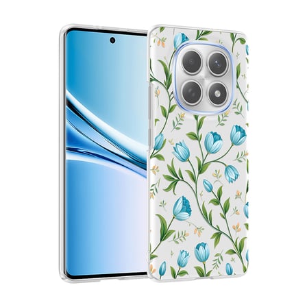 Xiaomi Redmi Note 15 5G Kılıf Kamera Korumalı Canlı Lüx Desenli Klip Sert Kapak Mavi Lale