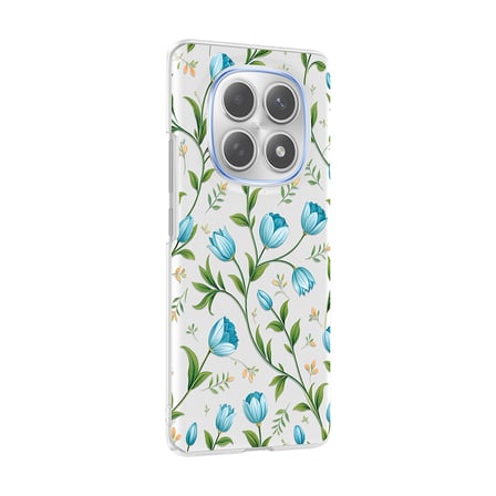 Xiaomi Redmi Note 15 5G Kılıf Kamera Korumalı Canlı Lüx Desenli Klip Sert Kapak Mavi Lale
