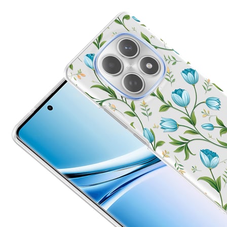 Xiaomi Redmi Note 15 5G Kılıf Kamera Korumalı Canlı Lüx Desenli Klip Sert Kapak Mavi Lale
