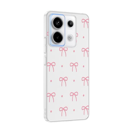Xiaomi Redmi Note 13 Pro 5G Kılıf Kamera Korumalı Canlı Lüx Desenli Klip Sert Kapak Fiyonk