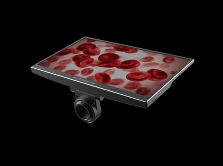 YW5612 11.6 İnç Hepsi Bir Arada Mikroskop Kamerası - 5MP 1080P@60FPS HDMI & USB Entegre Monitörlü Dijital Mikroskop Ekranı
