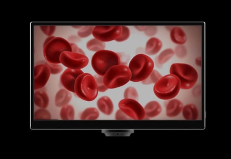YW5612 11.6 İnç Hepsi Bir Arada Mikroskop Kamerası - 5MP 1080P@60FPS HDMI & USB Entegre Monitörlü Dijital Mikroskop Ekranı