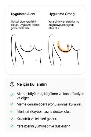 Meme Estetiği Sonrası İz Giderici Silikon Yara İzi Örtüsü – Yıkanabilir | Anchor Model | 2 Adet