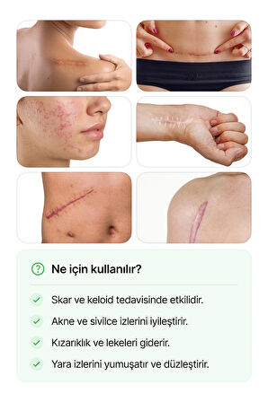 Silikon Bant Skar-Keloid-Yanık-Sezeryan-Estetik Ameliyat İzi Giderici 2,5 cm x 3 m