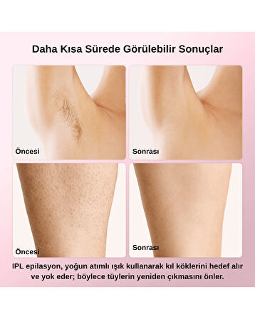 pure es T4 Taşınabilir IPL Lazer Epilasyon Cihazı 