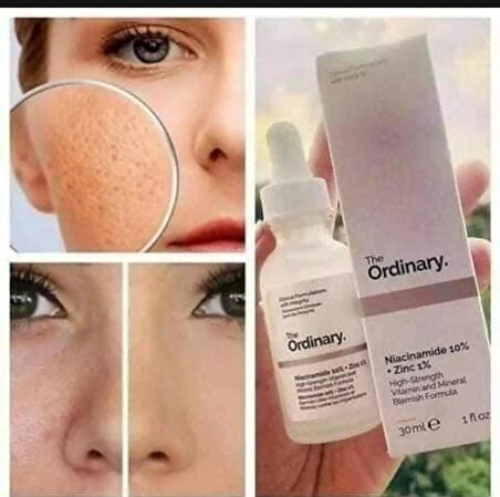 The Ordinary Niacinamide 10% + Zinc 1% Yüz Serumu 30 ml