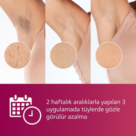 Lumea IPL Tüy Alma Cihazı, Çantalı, Yüz Temizleme Cihazı Hediyeli, Yüz/Vücut/Hassas Bölge Kullanımı, Cilt Tonu Sensörü ile Güvenli Epilasyon BRI924/00