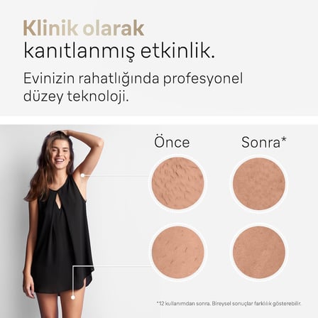 IPL Silk·expert Pro 5, Evde Tüy Alma, Çanta, Venus Tıraş Makinesi, 2 Başlık ile, PL5152